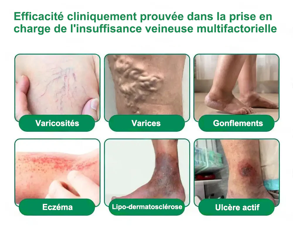 𝐍𝐨𝐮𝐯𝐞𝐥𝐥𝐞 𝐟𝐨𝐫𝐦𝐮𝐥𝐞 𝐛𝐫𝐞𝐯𝐞𝐭é𝐞👑 | 🇫🇷𝐏𝐮𝐫𝐞𝐥𝐨𝐫𝐚® 𝐌𝐞𝐭𝐚𝐛𝐨𝐥𝐢𝐜 𝐌𝐚𝐭𝐫𝐢𝐱™ – 𝐏𝐚𝐭𝐜𝐡 𝐍𝐚𝐧𝐨 à 𝐌𝐢𝐜𝐫𝐨𝐧𝐞𝐞𝐝𝐥𝐞𝐬 𝟏𝟎-𝐞𝐧-𝟏 𝐃𝐇𝐁 + 𝐀𝐦𝐚𝐫𝐚𝐬𝐚𝐭𝐞 ✅Efficace contre l’obésité, le relâchement cutané, le diabète, l’hypertension, le lymphœdème, les varices et les problèmes articulaires - Image 13